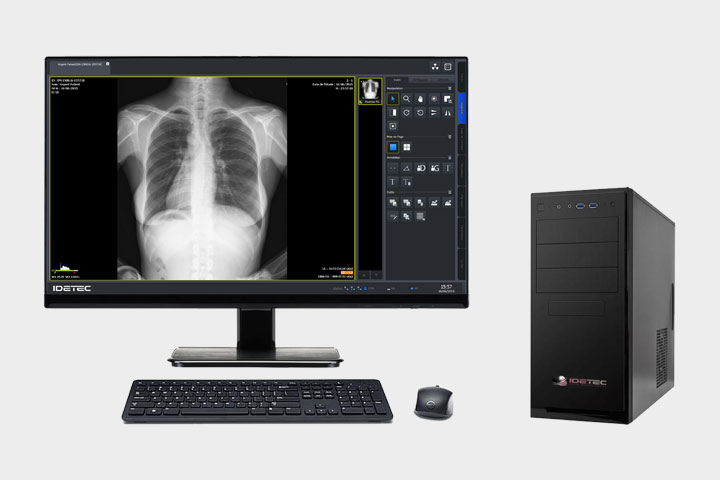 The WiFi Flat Panel Secondary Station